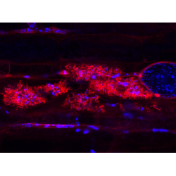 lipids visible in arbuscules